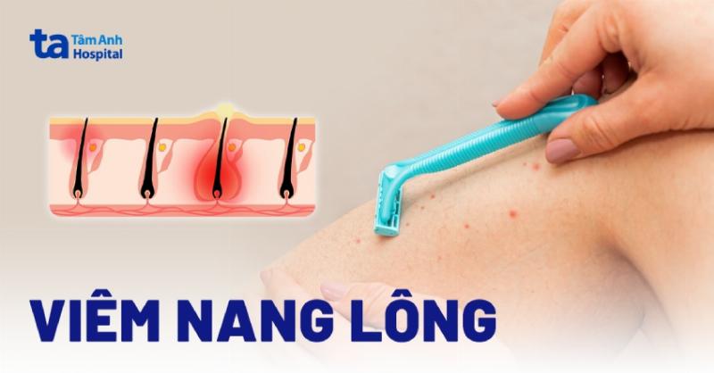 Mot chu cho dang duoc cham soc ve sinh chan long, the hien viec phong ngua xa mau