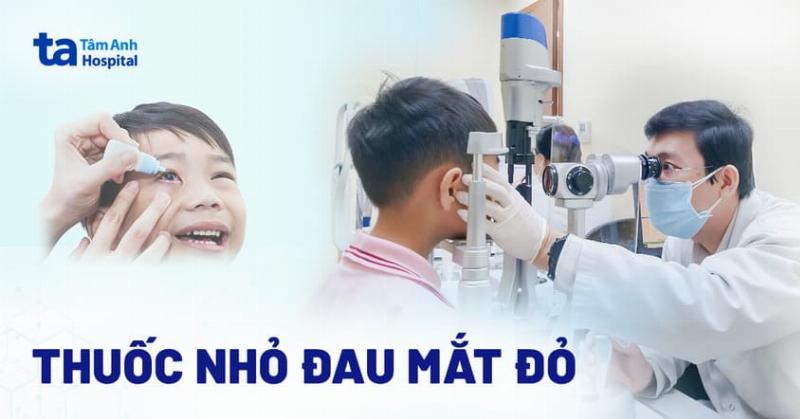 Mot so loai thuoc nho mat dieu tri meo bi dau mat do pho bien