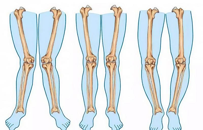 Hình ảnh cận cảnh chân của một con chó con bị biến dạng (chân vòng kiềng hoặc sưng khớp), minh họa dấu hiệu thiếu canxi nghiêm trọng