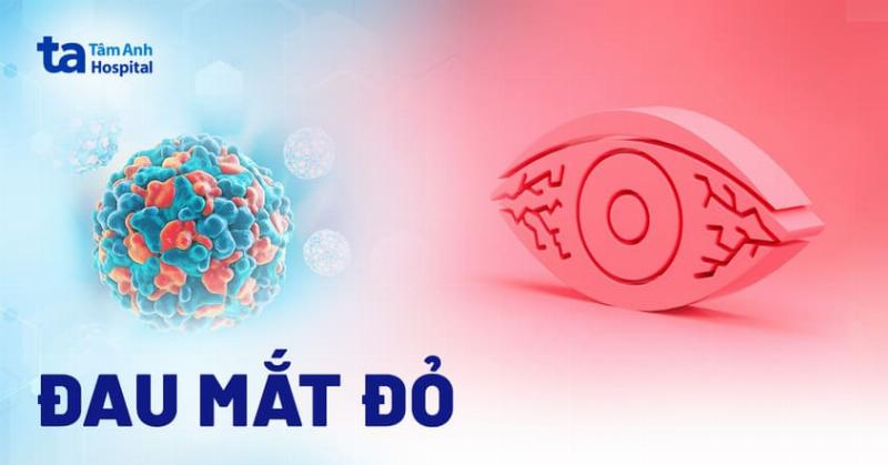 Hinh anh mat meo bi dau mat do voi trieu chung sung do chay nuoc mat