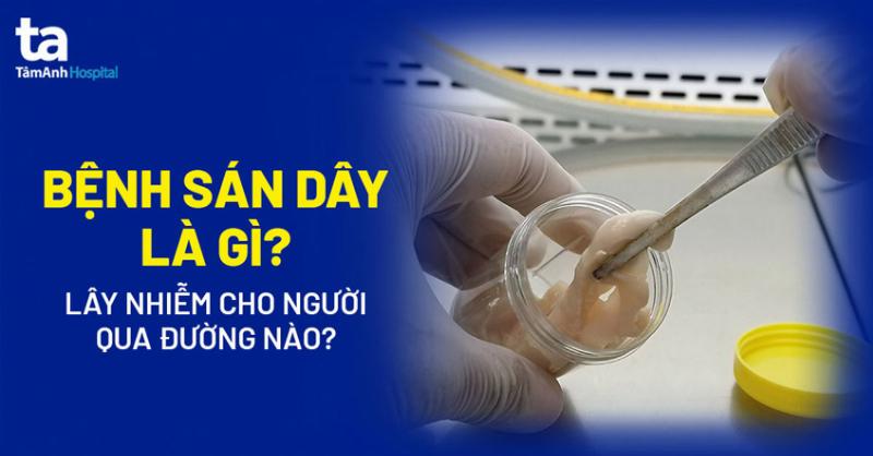 Hình ảnh minh họa các loại giun sán phổ biến ở mèo: giun đũa, giun móc, sán dây.
