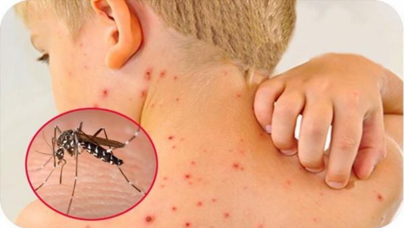 Câu hỏi thường gặp về rận mèo
