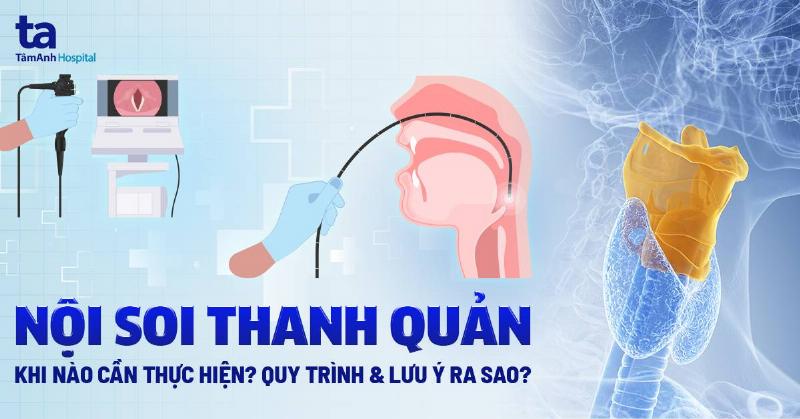 Minh họa cách giữ đầu mèo và mở miệng nhẹ nhàng để đưa thuốc viên vào sâu trong cuống họng
