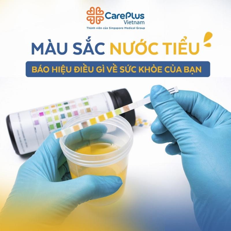 Hinh anh cho dang vui ve uong nuoc sach tu bat