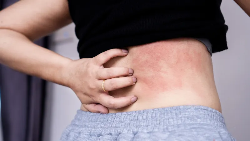 Các dấu hiệu phổ biến cho thấy mèo của bạn có thể cần dùng thuốc nhỏ mắt cho mèo để điều trị vấn đề về mắt