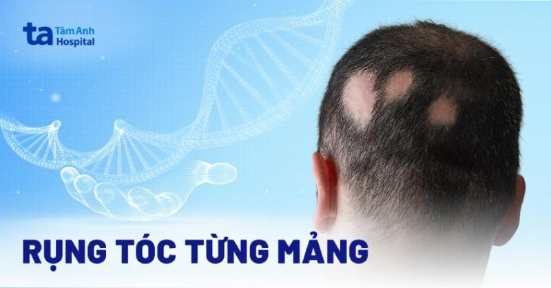 Hinh anh vung da meo bi man do va rung long thanh mang