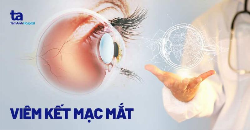 Hinh anh meo bi chay nuoc mat do viem ket mac, mat do va co dich