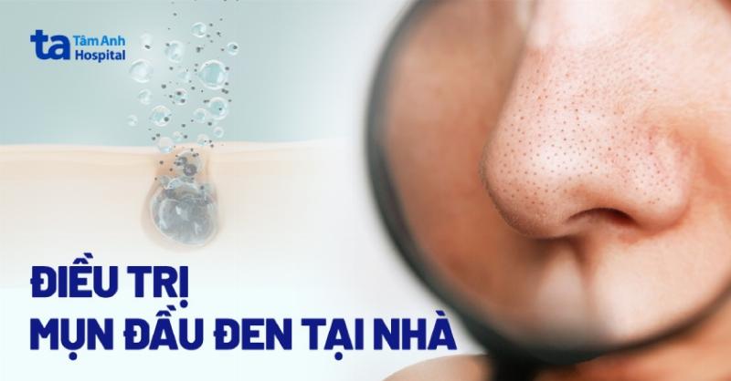 Mèo già có thể khó tự vệ sinh vùng cằm, làm tăng nguy cơ xuất hiện đốm đen.