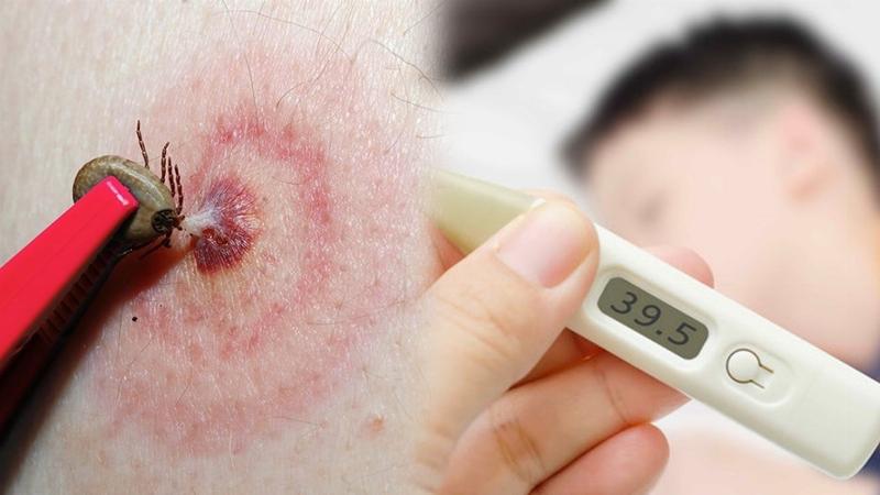 Người chủ nhỏ thuốc trị ve chó lên gáy cún cưng