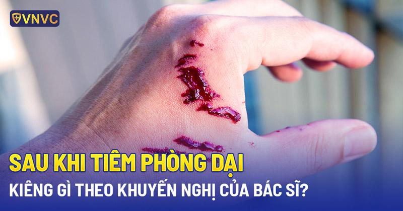 Theo dõi sức khỏe chó sau tiêm