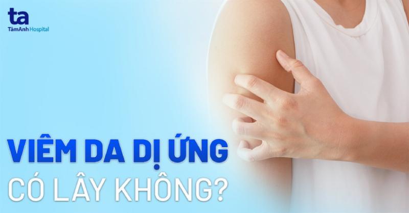 Cho bị viêm da ngứa gãi, dấu hiệu dị ứng thức ăn cần tránh