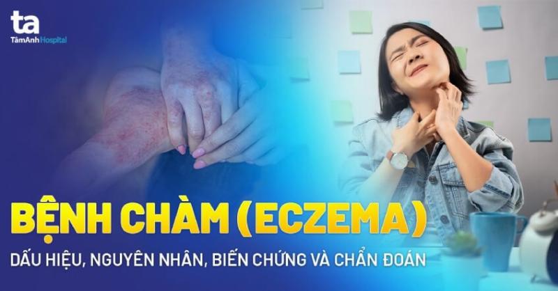 Hình ảnh cận cảnh da chó bị mẩn đỏ khô vảy, biểu hiện viêm da dị ứng
