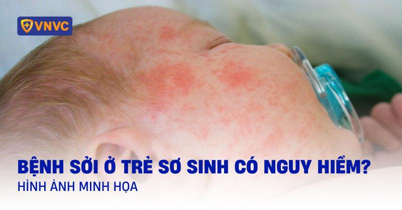 Hinh anh meo con 1 thang tuoi mat me co dau hieu benh nhu bo bu