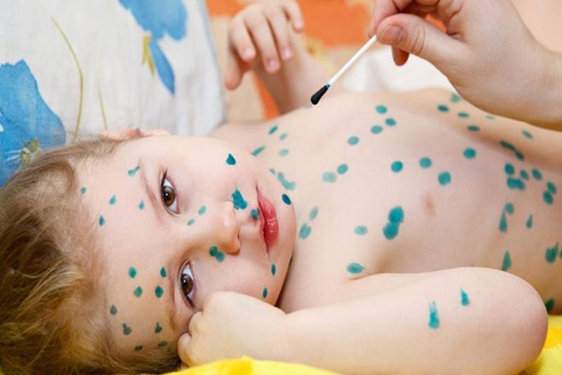 Bác sĩ thú y đang thực hiện kỹ thuật cạo da nhẹ nhàng trên vùng da bị ảnh hưởng của chó con để lấy mẫu xét nghiệm tìm ve ghẻ xà mâu dưới kính hiển vi.