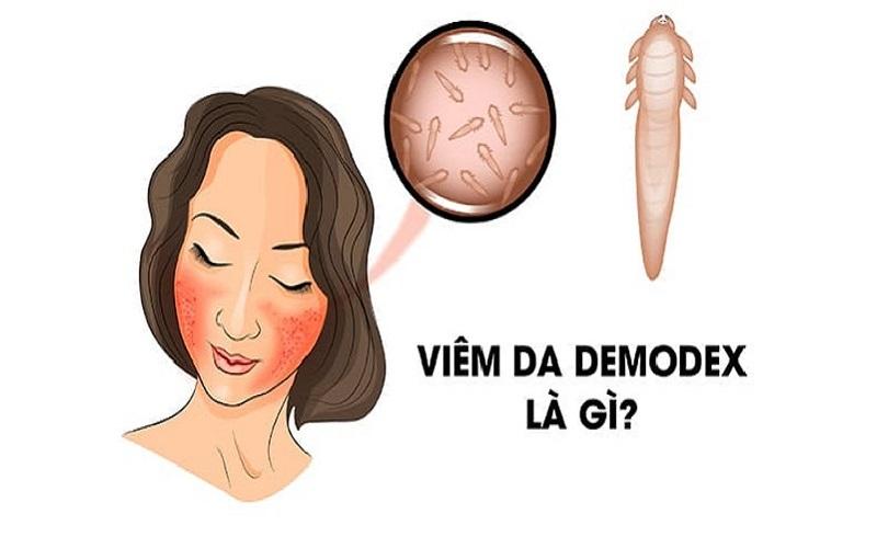Hinh anh ky sinh trung ghe demodex duoi kinh hien vi tren da cho