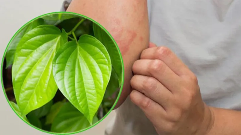 Lá trầu không và cách dùng trị ghẻ nước tại nhà