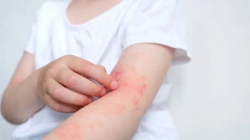 Vệ sinh và phòng ngừa giun sán cho mèo hiệu quả