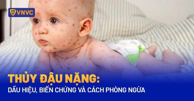 Thoi diem quan trong dua cho den tham kham bac si thu y khi benh nang