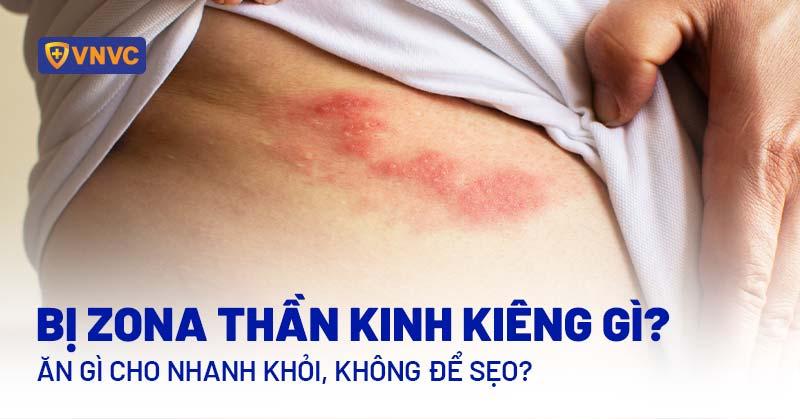 Các loại thức ăn chó bị nấm nên kiêng như bánh mì, kẹo, ngũ cốc