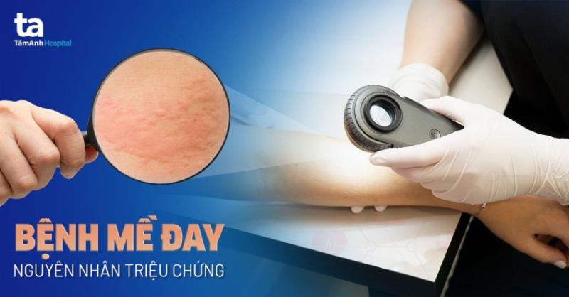 Hình ảnh minh họa các vùng da khác nhau trên cơ thể chó bị viêm, ngứa và rụng lông do các nguyên nhân đặc thù